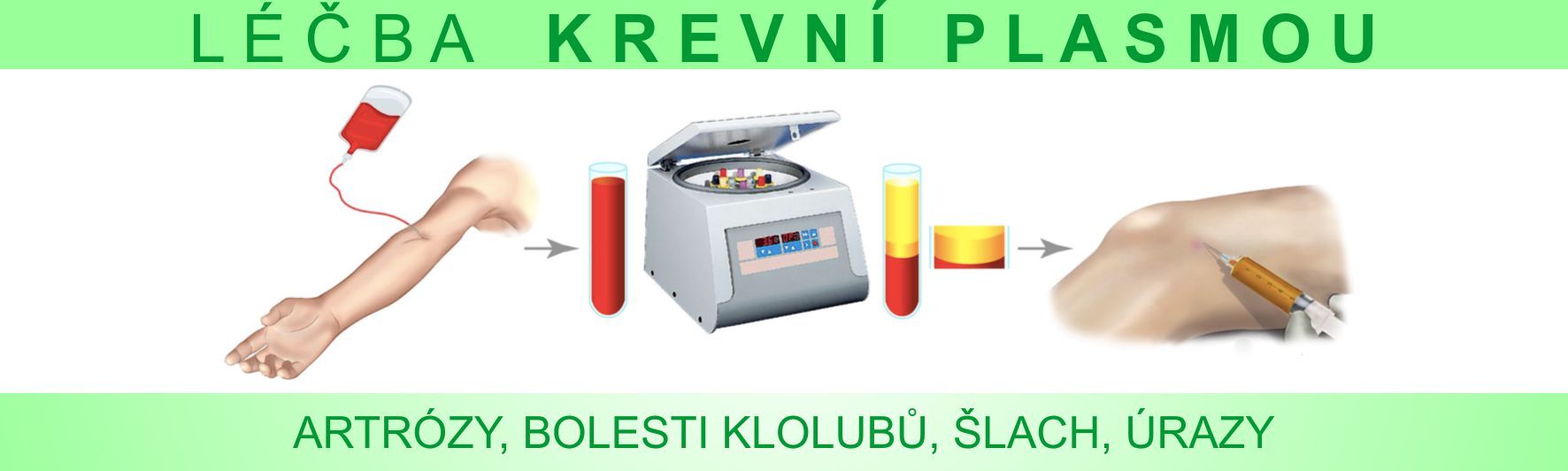 PLASMA PRP